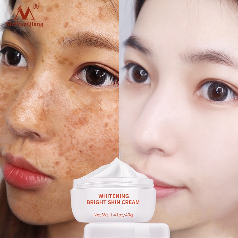 [100% Asli] Cream Skin Care Anti Freckle Whitening Moisturize Cream-cream pemutih-wajah glowing krim cream penghilang flek hitam membandel cream pemutih-wajah glowing pencerah wajah