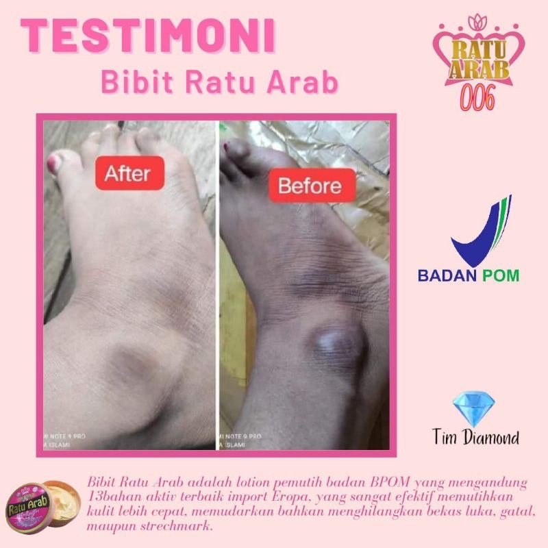 BIBIT RATU ARAB BPOM PEMUTIH INSTAN 3 HARI BPOM HANDBODY PEMUTIH BADAN KEMASAN BARU