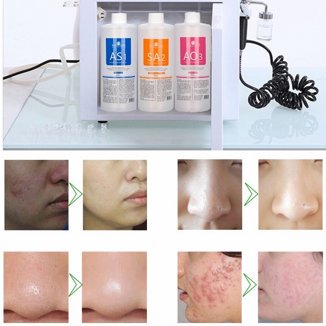 400ML Cairan Hydra Serum Hydra peel AS1 AO3 SA2 Oxygen spray Aqua Dermabrasion Serum Hydra Aqua Dermabrasion Oxygen Peel Hydro Aqua Peel Original 3Pcs