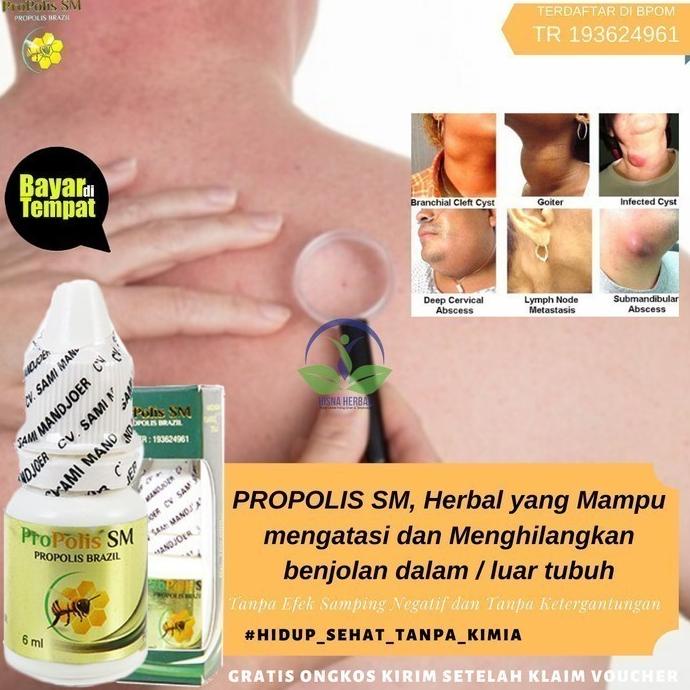 

BISA COD Obat Oles Penghilang Benjolan Paha / Kaki / Wajah / Belakang Telinga /OBAT TELINGA BERDENGUNG/OBAT TELINGA BERAIR/OBAT TELINGA TERSUMBAT/OBAT TELINGA BUDEG/OBAT TELINGA BERNANAH