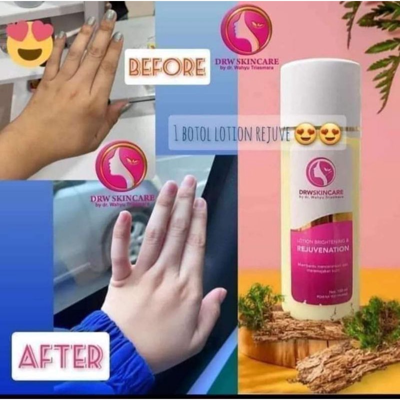 Paket HB rejuvenation DRW