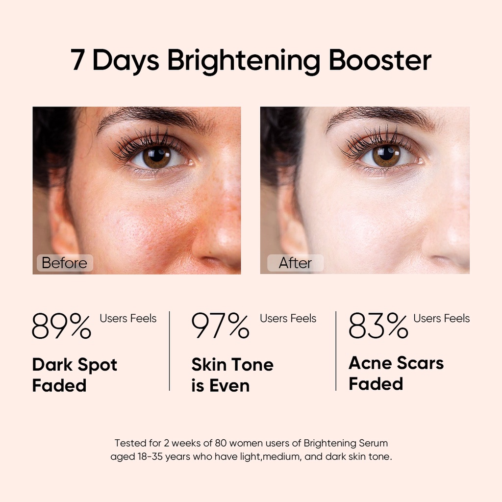 Skintific - 10% Niacinamide Serum (20 ml)