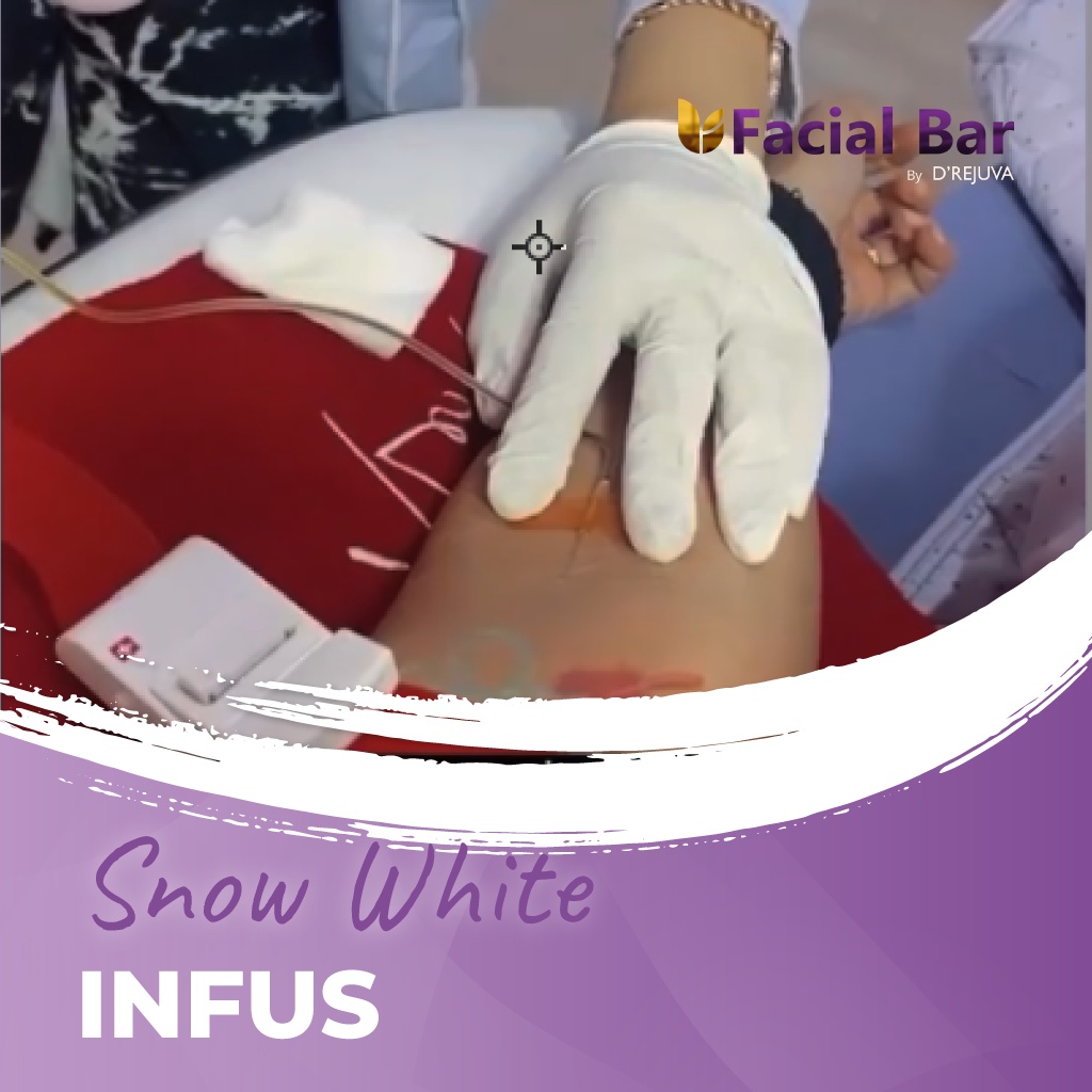 Snow White Infus