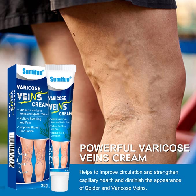 Eftkeif Permanen Krim Varises Cream Varises Angiitis Salep Flebitis Kaki Obat Krim Varises Parises T