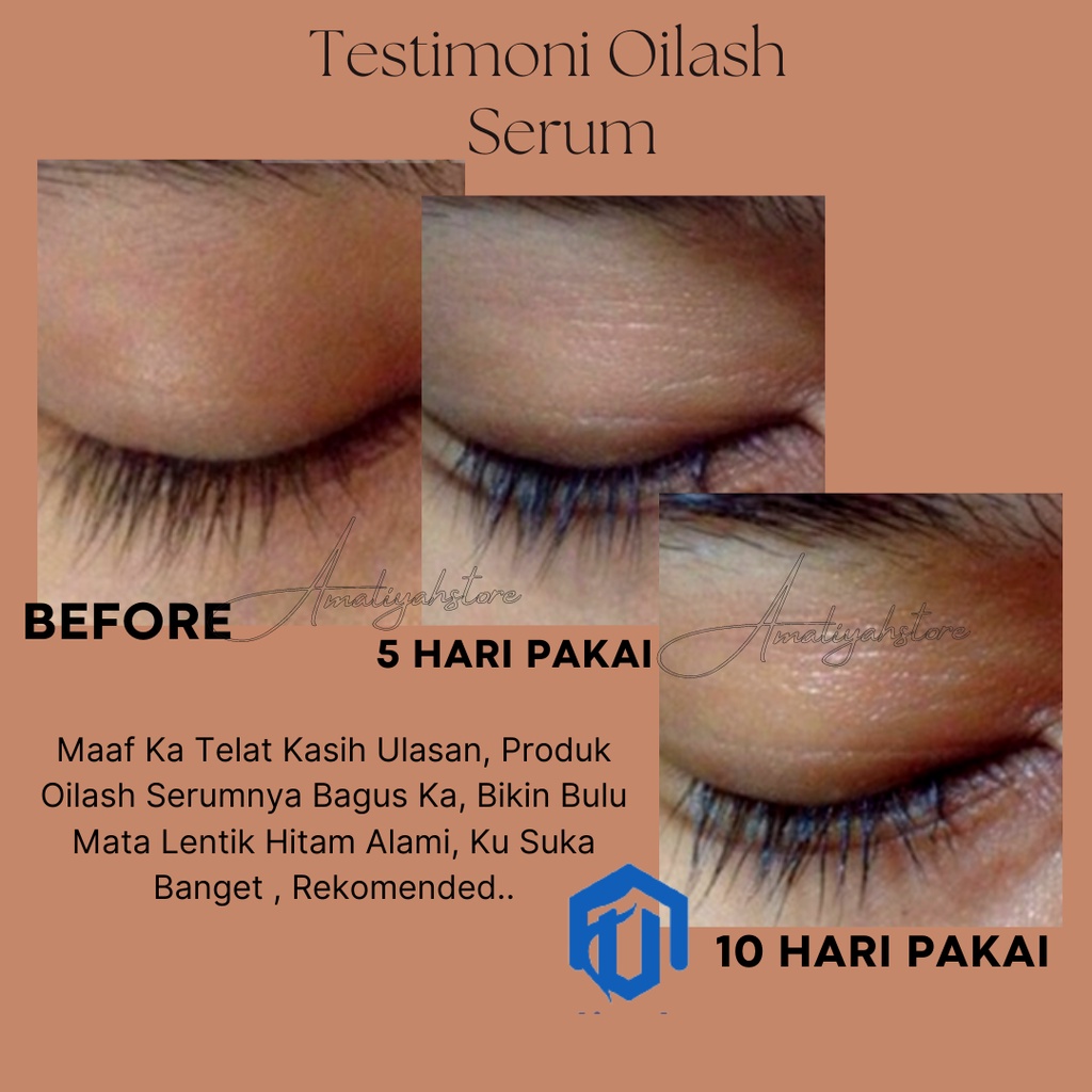 Oilash Serum Bulu Mata Ori Alat Gel Pelentik Penebal Pelebat Pemanjang Alis Mata Pria &amp; Wanita 10 Ml Ampuh Permanen Original Bpom