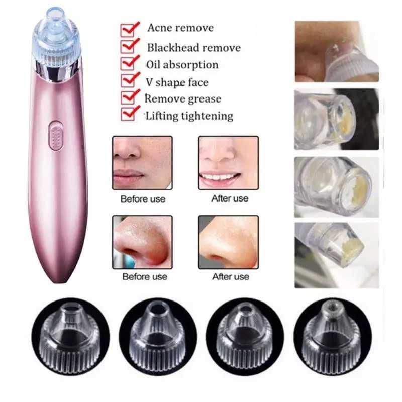 Alat Penyedot Komedo Dan Jerawat CW 666 Beautiful Skin Care Expert