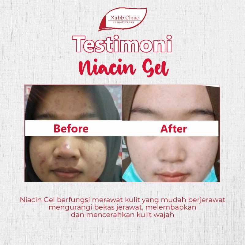 Niacin Gel