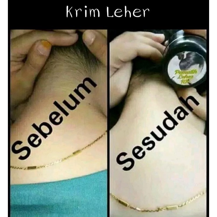 KRIM LEHER / PEMUTIH LEHER