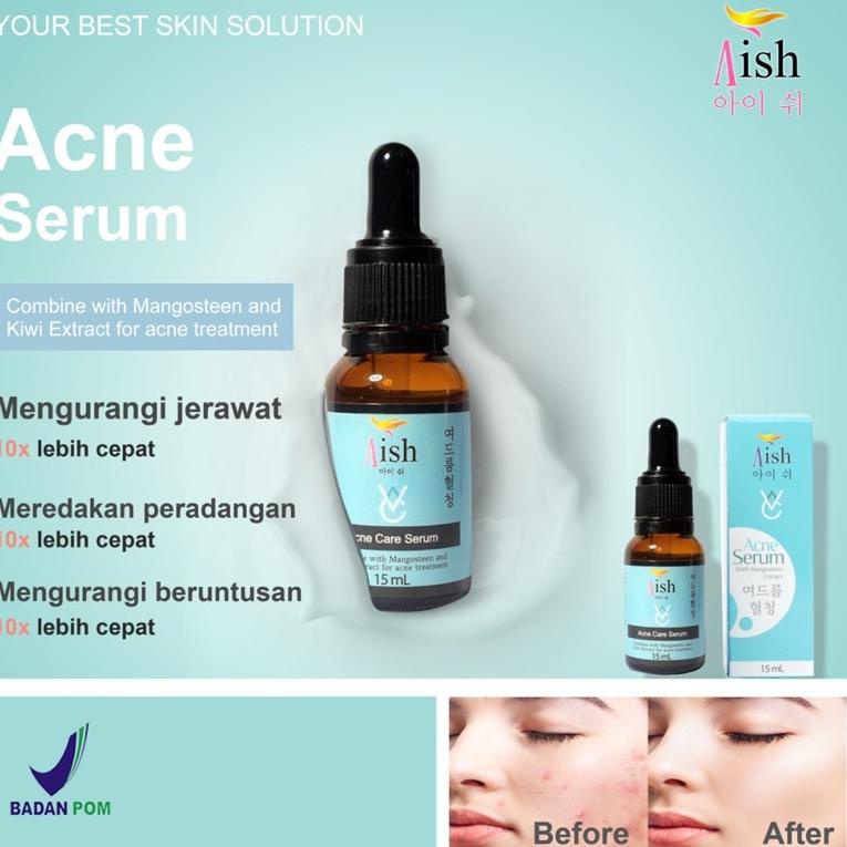 Y84S AISH SERUM ORIGINAL SERUM AISH ORIGINAL KOREA AISH SERUM KOREA BPOM / AISH SKINCARE / ACNE 100%