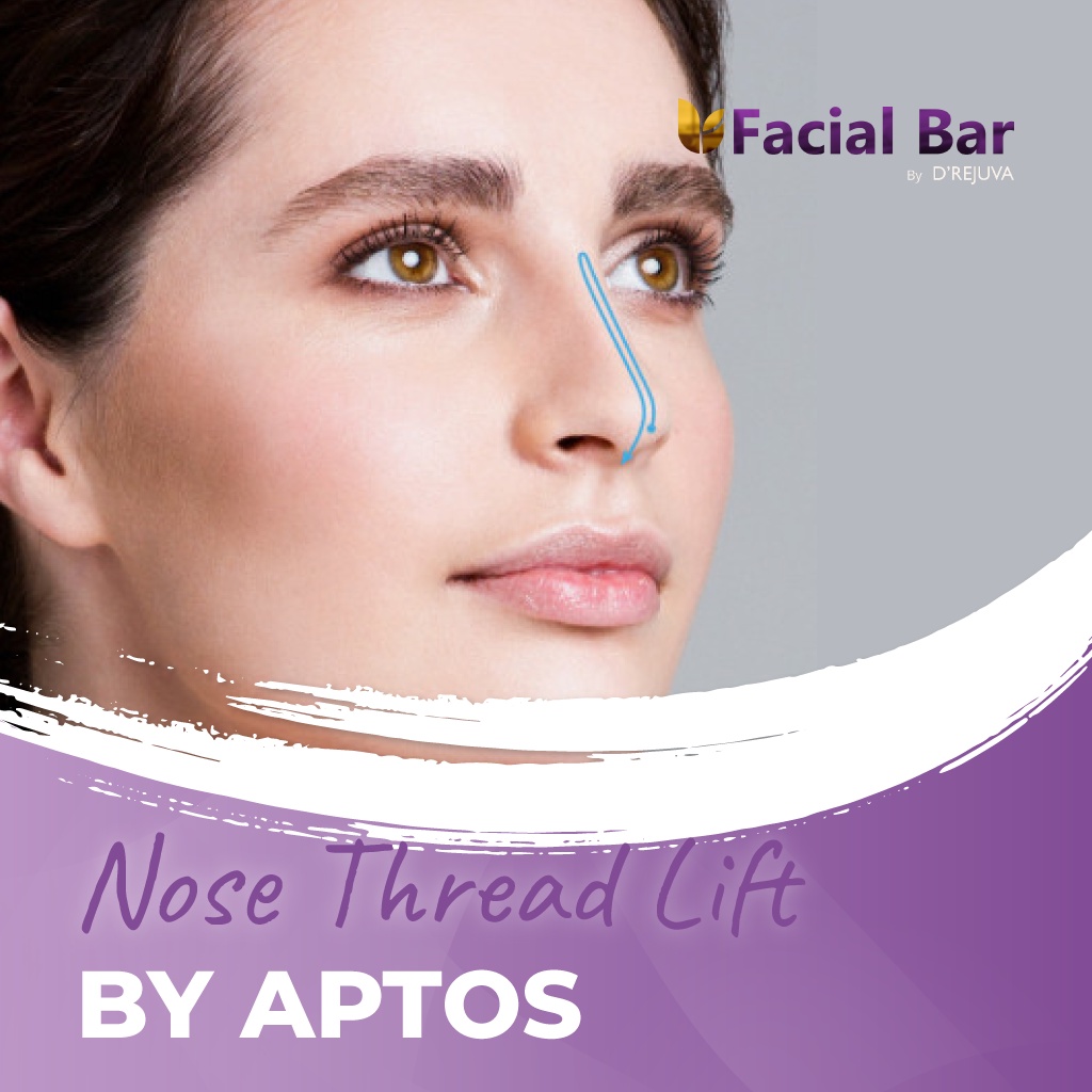 Nose Thread Lift
