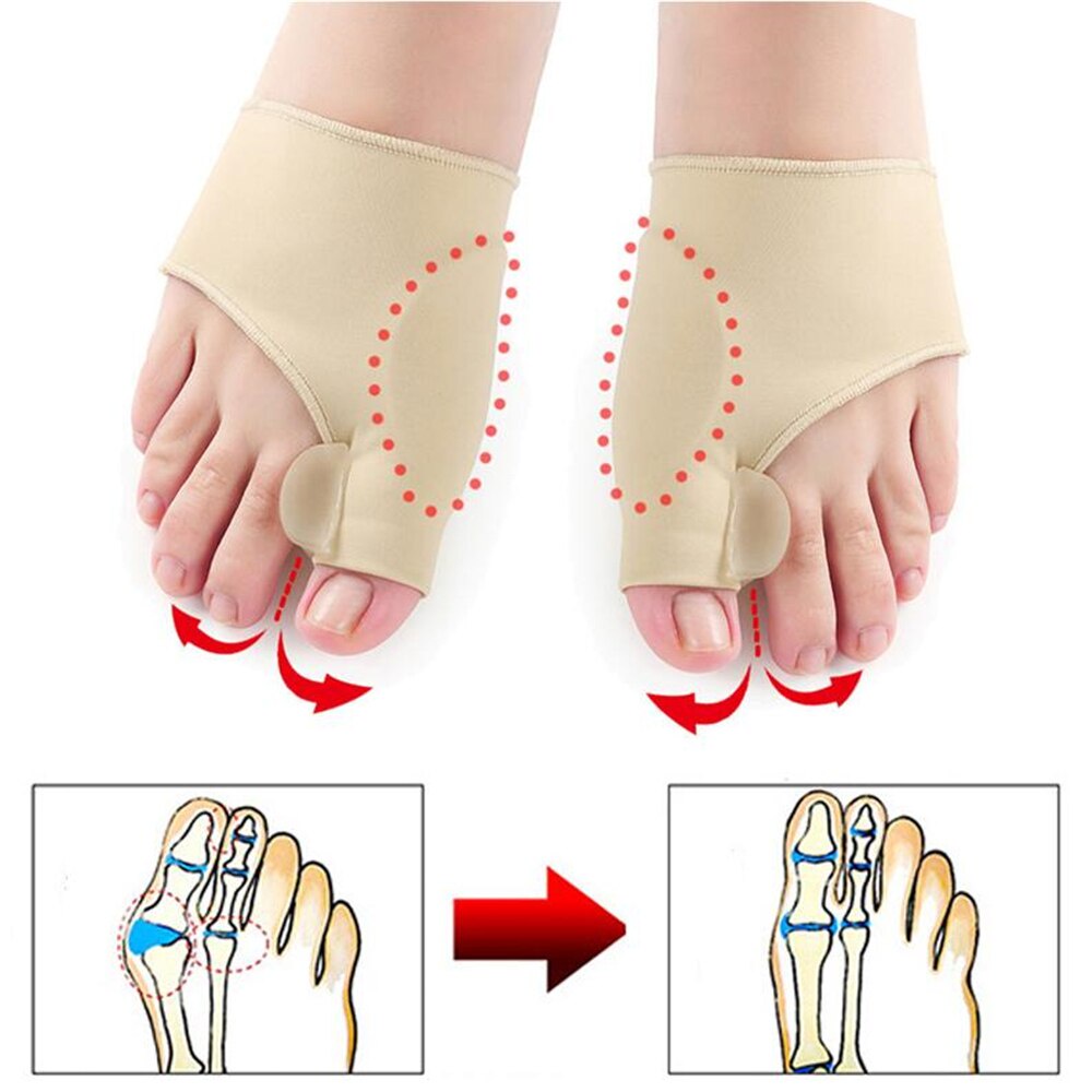 PELURUS JEMPOL KAKI HALLUX VALGUS BUNION CORRECTOR SLEEVE KOREKTOR TULANG JEMPOL 2 PCS (SEPASANG)