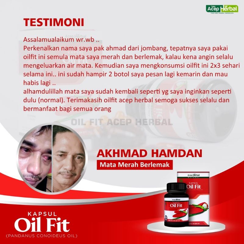 Obat Pterygium di Mata | Oil Fit Herbal