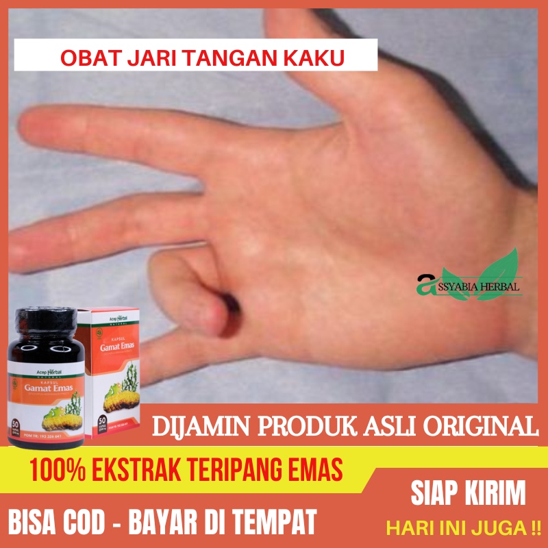 Obat Jari Tangan Kaku / Tangan Kaku / Sakit Tangan dan Nyeri Otot / Triggerfinger / Jari Kaki Bengka