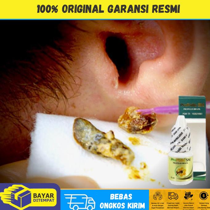 

Sale Propolis SM - Obat Pelunak Kotoran Telinga Keras Kering Menumpuk /OBAT TELINGA BERDENGUNG/OBAT TELINGA BERAIR/OBAT TELINGA TERSUMBAT/OBAT TELINGA BUDEG/OBAT TELINGA BERNANAH