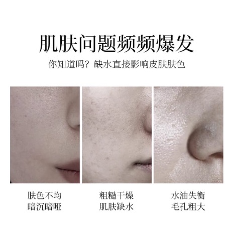 Veze Whitening Anti-Freckle Paket 4 PCS LS