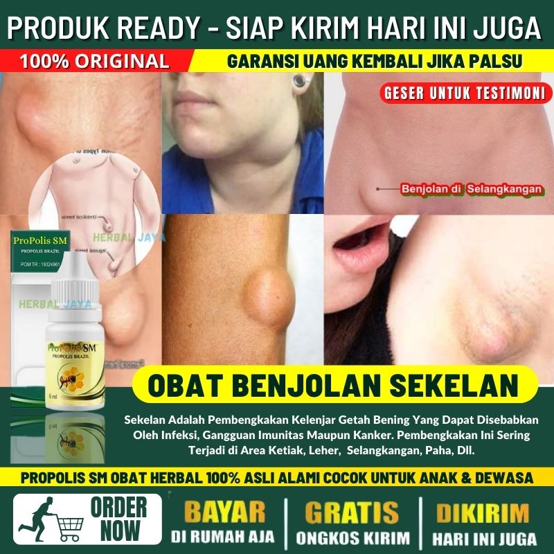 Obat Sekelan di Selangkangan, Obat Oles Benjolan di Selangkangan, Penghilang Benjolan di Selangkanga