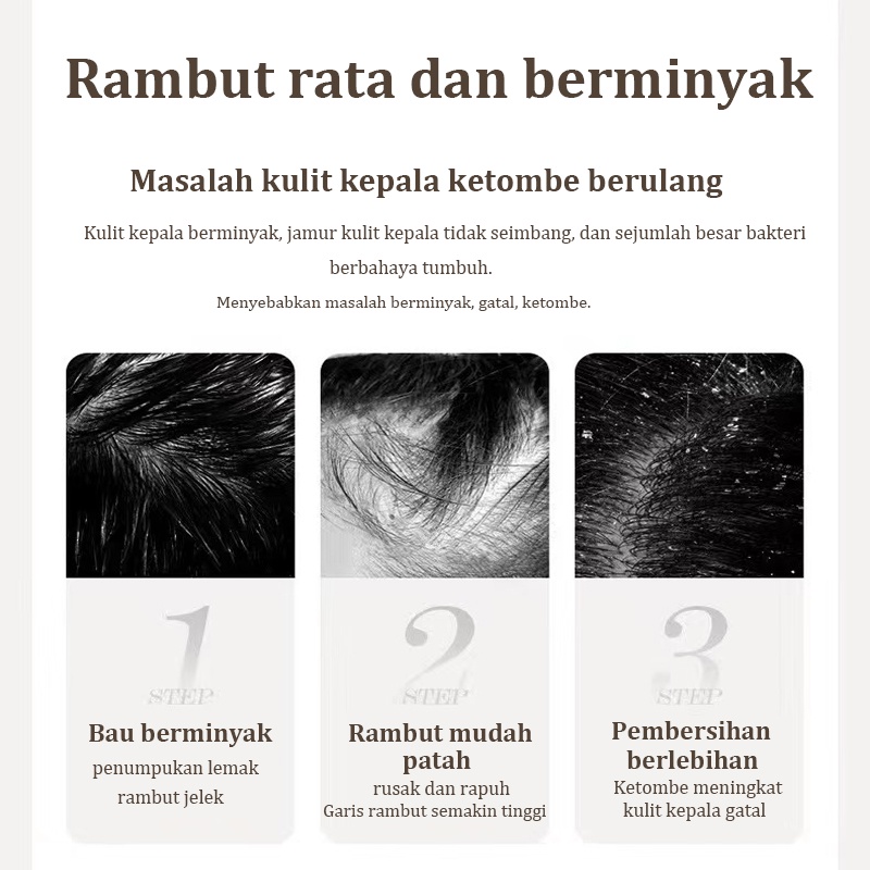 Sampo anti ketombe Sampo anti-rambut rontok Shampoo 400ML Kontrol minyak dan anti ketombe Mencegah rambut rontok Lembut dan tidak menjengkelkan Kontrol minyak yang menyegarkan