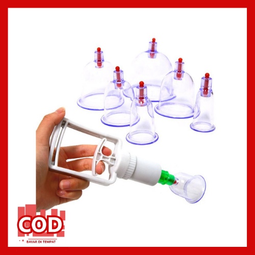 Alat Bekam Kop Angin Kaca Isi 6 Original Lengkap