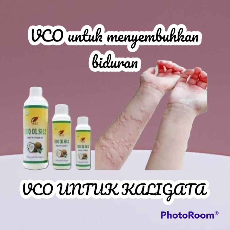 VCO UNTUK BIDURAN GATAL-GATAL ATAU KALIGATA