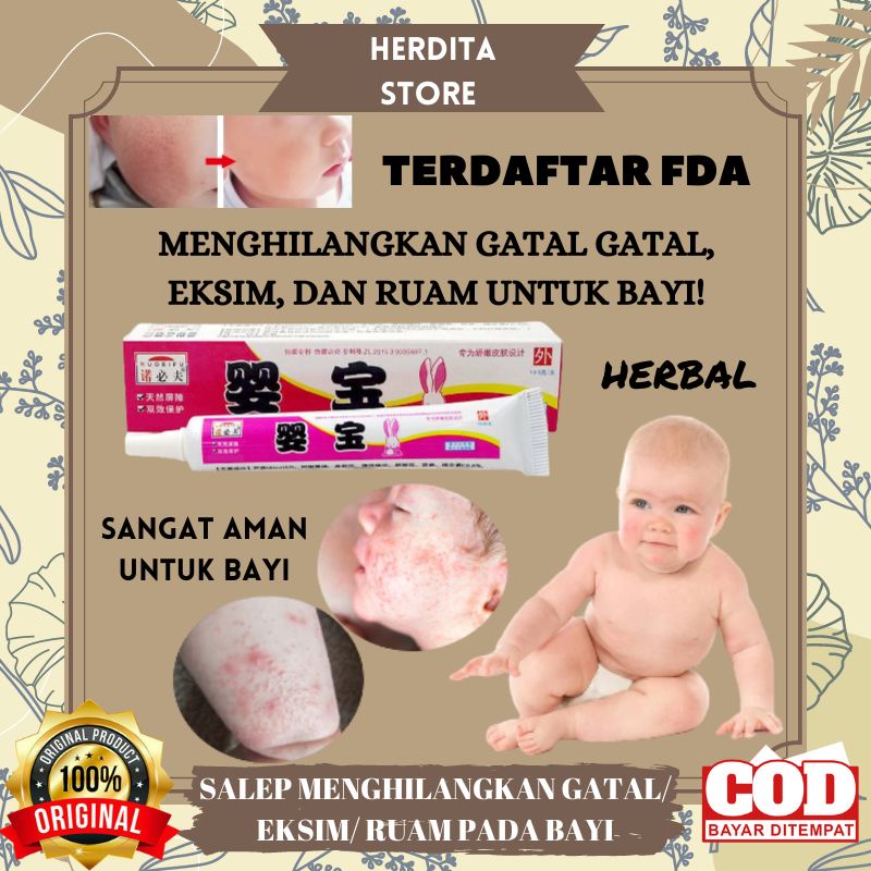 Original Salep gatal biang keringat bayi penghilang bintik bintik merah pada bayi Exp Baru