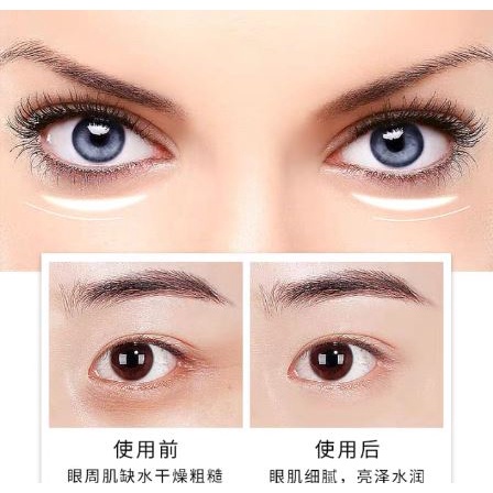 Veze Eye Cream PELEMBAB/MENGENCANGKAN Garis Halus Dan Menghilangkan Lingkaran Hitam Mata