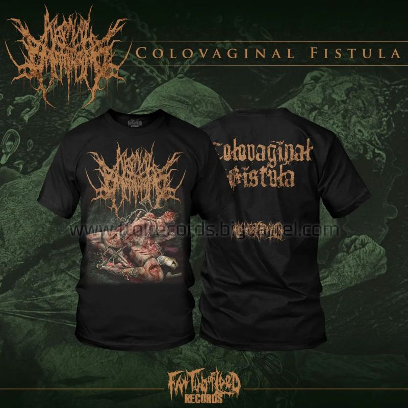 T-shirt - AGONAL BREATHING - Colovaginal Fistula