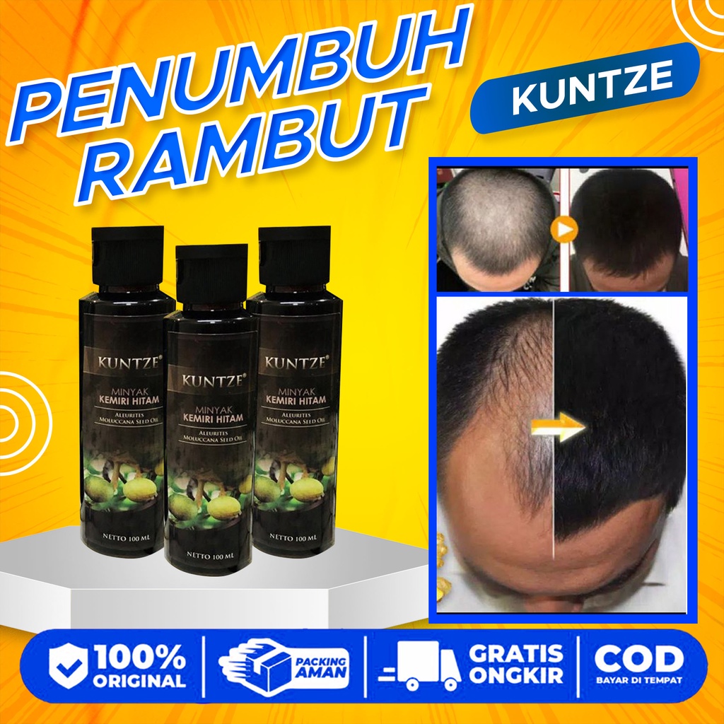 Minyak kemiri perawatan rambut rontok / Minyak kemiri anti botak / Kuntze minyak kemiri / Minyak kem