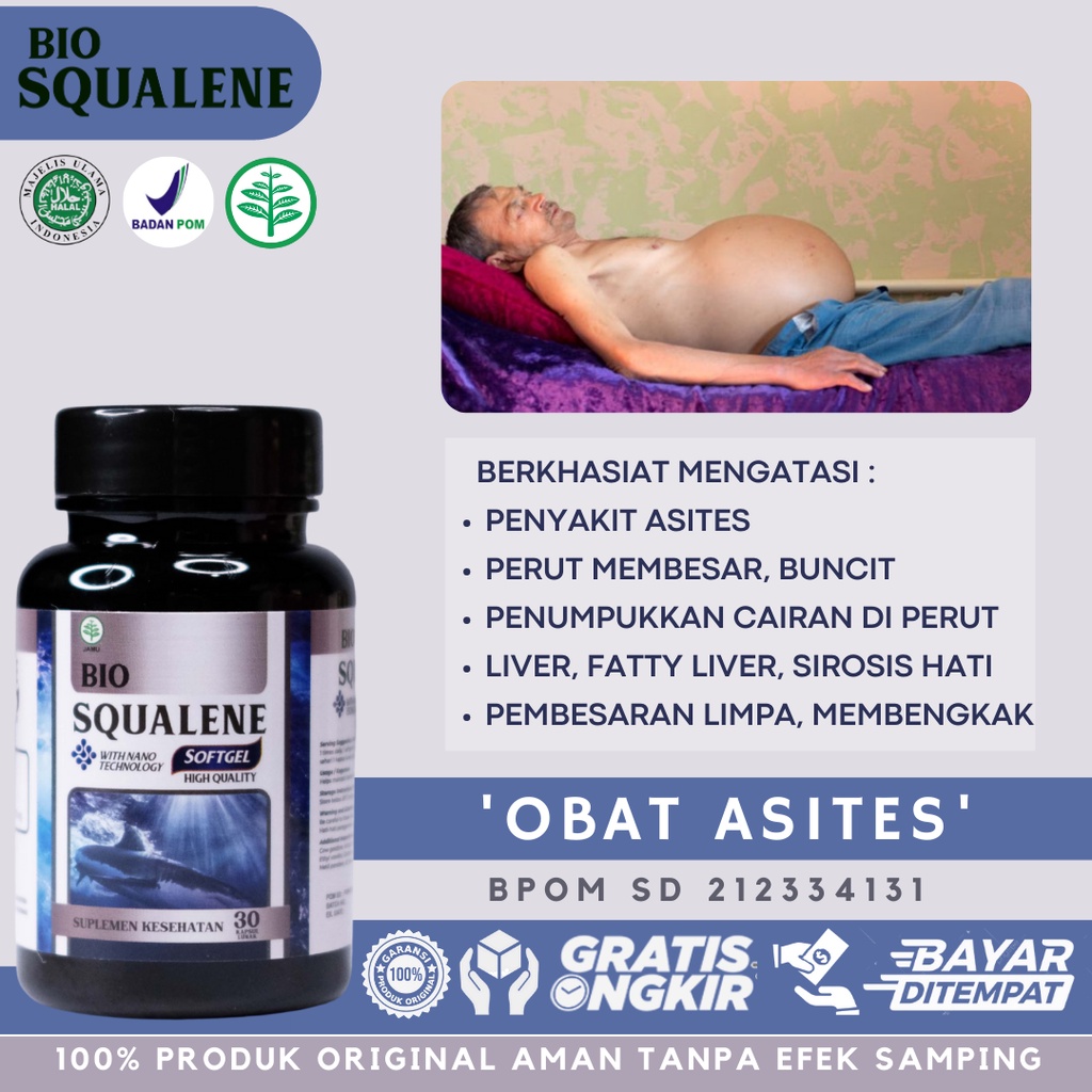 Jual Obat Asites Ascites Perut Bengkak Buncit Busung Air Penumpukkan