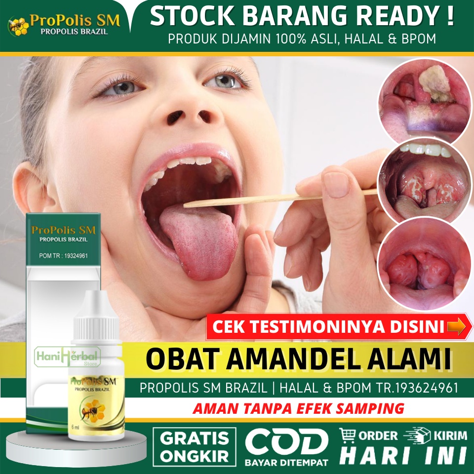 Obat Amandel Pada Anak & Dewasa 100% Alami Tanpa Efek Samping - Obat Radang Tenggorokan, Sakit Tengg