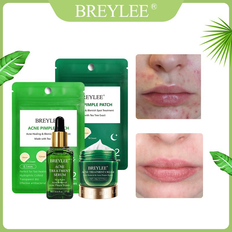 Breylee Krim Serum Pembersih Jerawat / Komedo + Pengontrol Minyak + Memutihkan