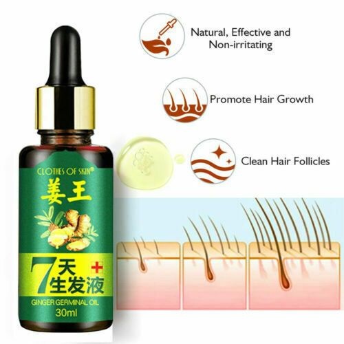 Serum Penumbuh Rambut / Anti Rontok Botak Ginger Germinal Oil-Ampuh Menumbuhkan Rambut &amp; Mencegah Kerontokkan-30ml