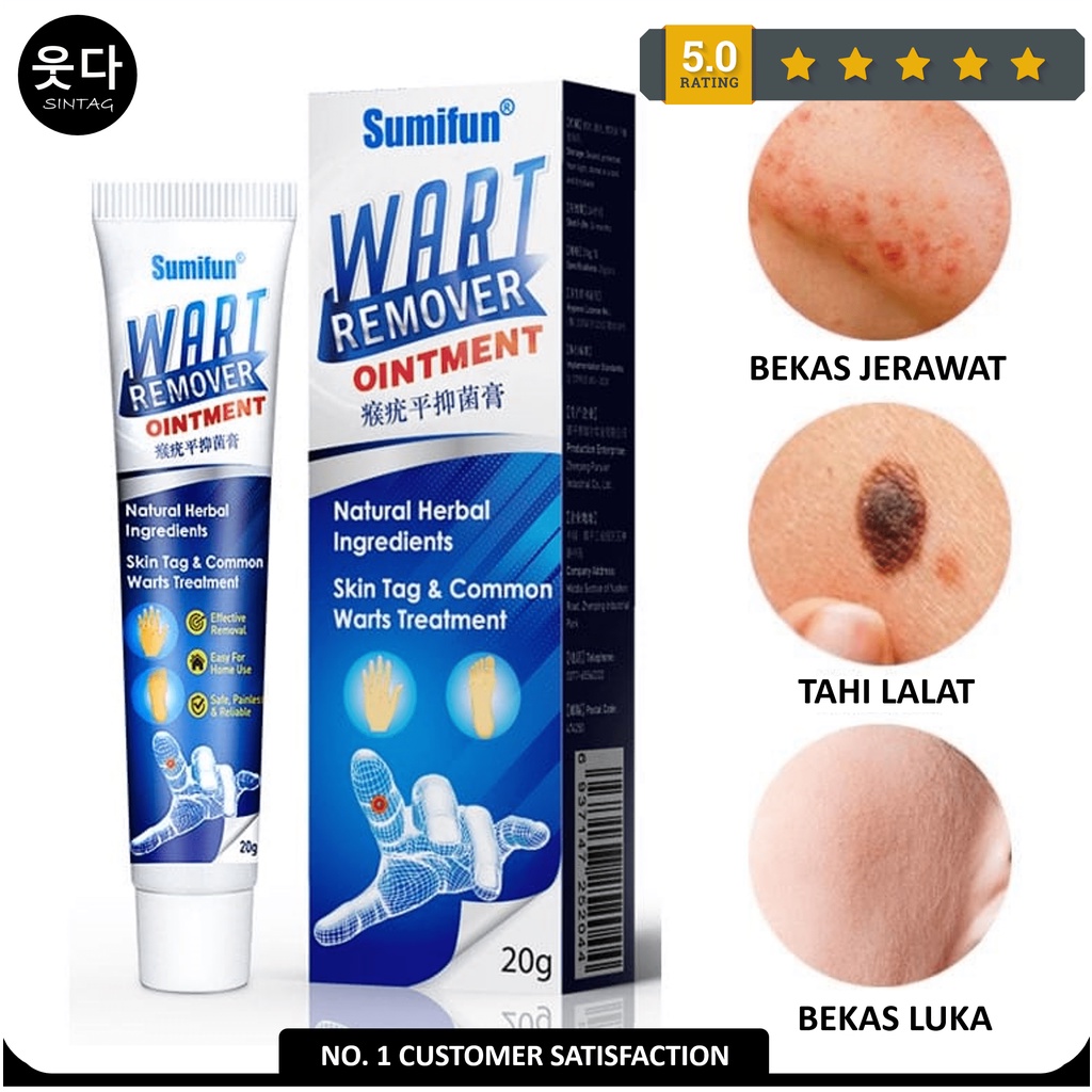 Krim Penghilang Kutil Sumifun Wart Remover, Tahi Lalat, Mata Ikan