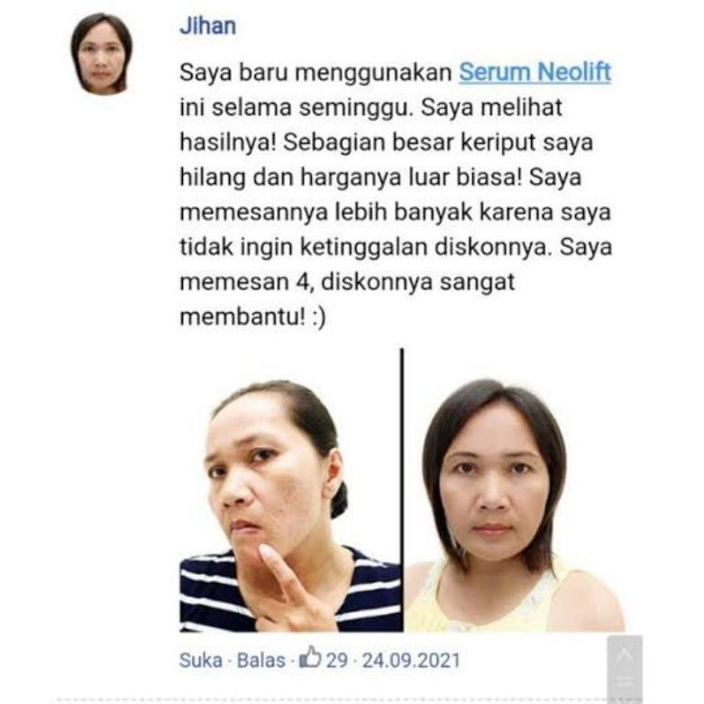 [KODE 1447] Neolift Asli Serum Wajah Anti Aging Tampak Lebih Mudah Bpom