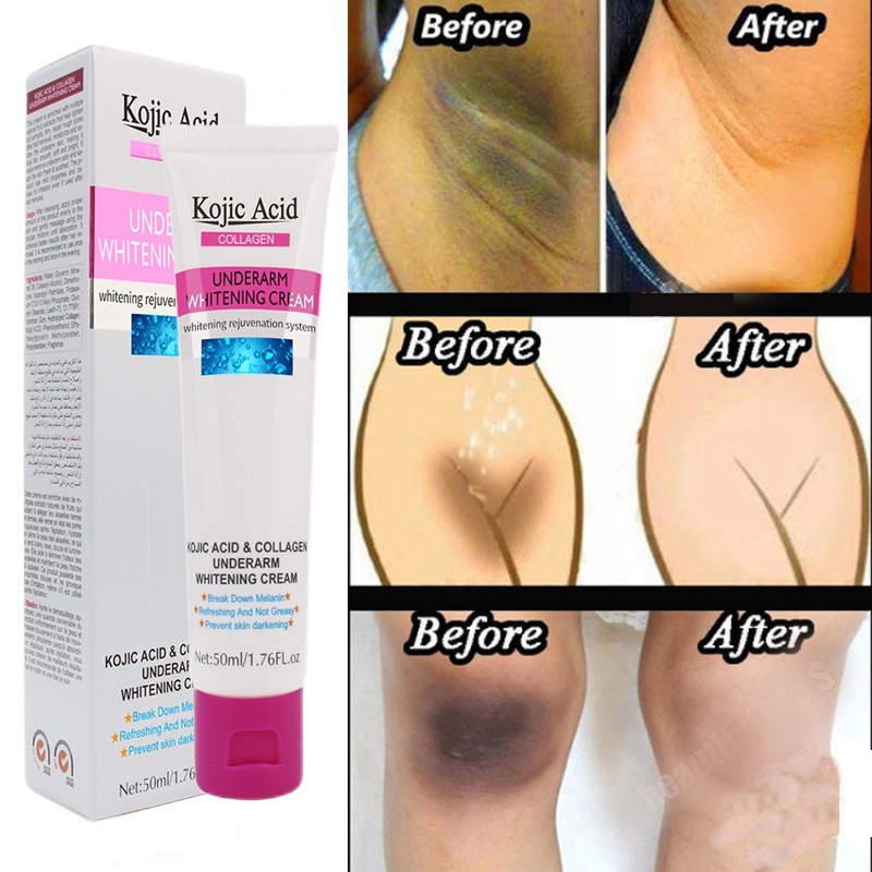 KOJIC ACID Underarm Cream Pencerah selangkangan Pemutih ketiak Pemutih selangkangan Memutihkan Selan