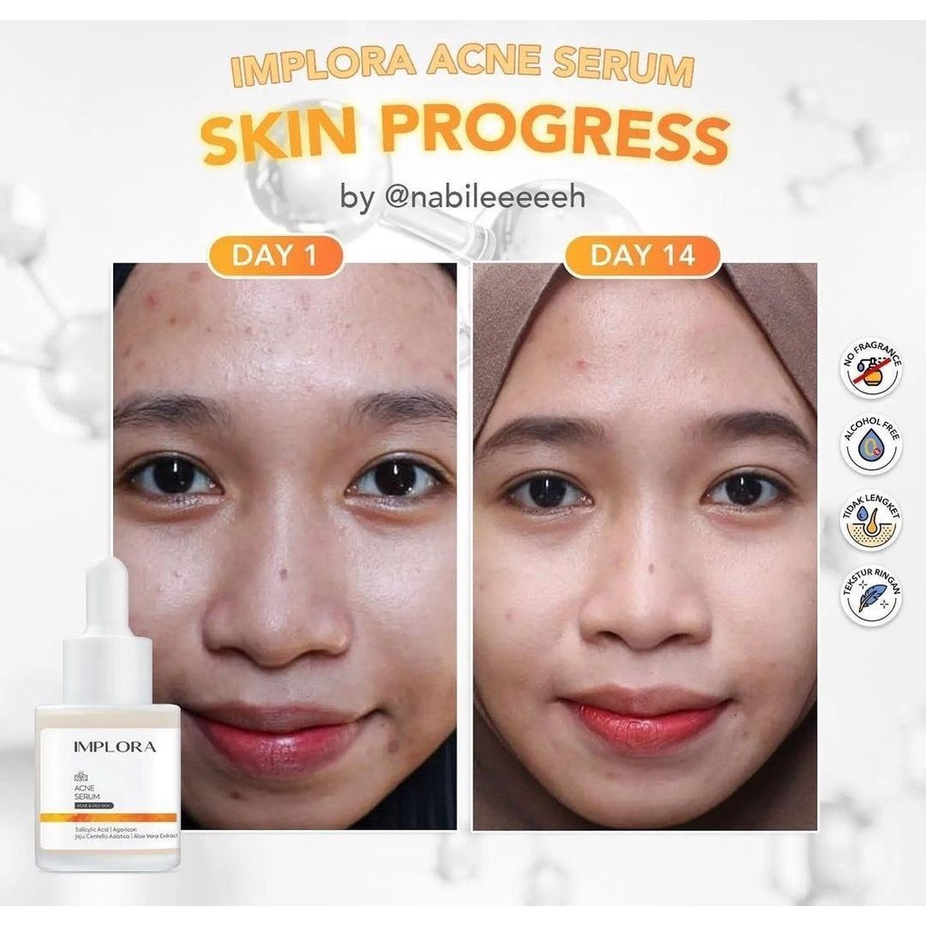 Implora Acne Serum - Serum Wajah Acne - Perawatan Wajah Serum Acne Implora Ori