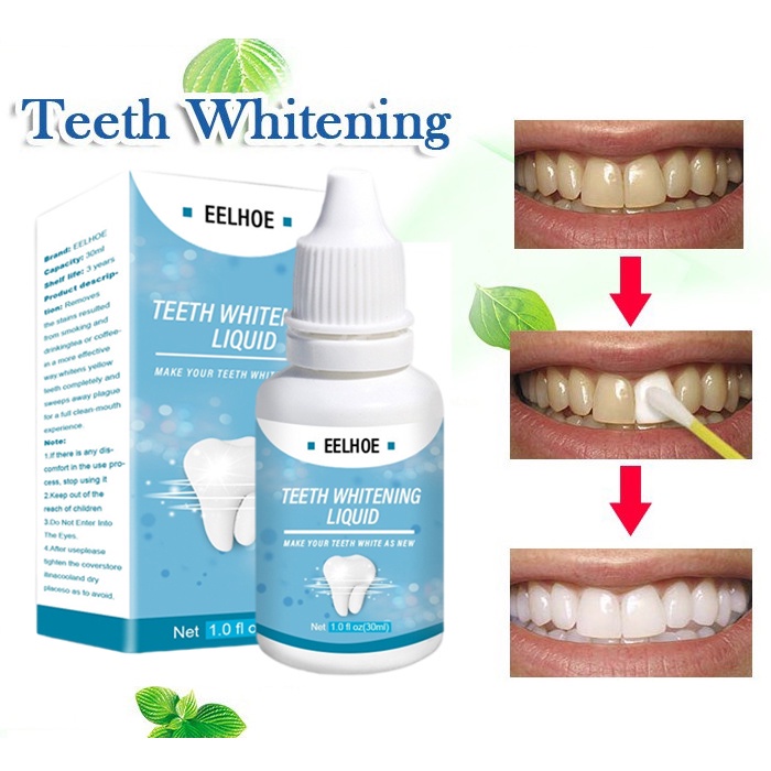 Pemutih Gigi Kuning Whitening teeth Bleaching tooth cairan pembersih gigi berbehel &amp; tidak - Alat bahan Penghilang Pembersih plak karang gigi ampuh