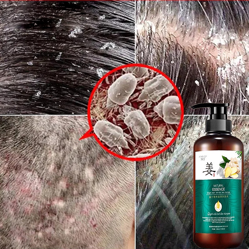 Shampo Penumbuh Rambut Mempercepat Pertumbuhan Shampo Anti Rambut Rontok 500ml Gatal Anti Rambut Rontok Fast Grow Shampoo Perawatan Rambut Rontok