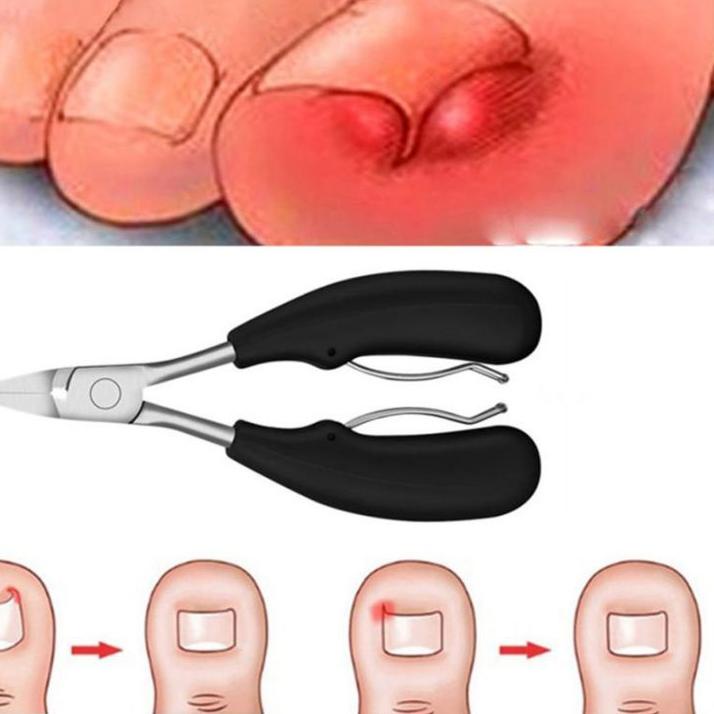 PALING BAGUS Biutte.co Gunting Kuku Jempol Kaki Anti Cantengan Toe Nail Clipper - MZ-020 € 853