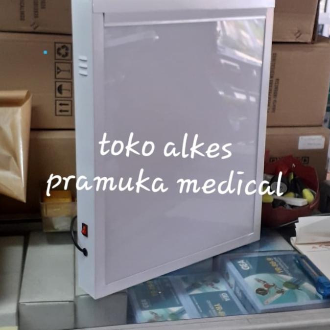 x ray viewer singgle lampu baca rontgen singgle LED