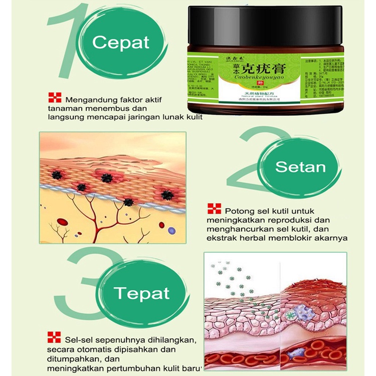 Obat Kutil kelamin HPV , Obat Perontok Kutil 20g, LOTION PENGHILANG KUTIL DAN TAHI LALAT Penghilang Papiloma di Leher dan Wajah, Menghilangkan Kutil Tahi Lalat Mata Ikan