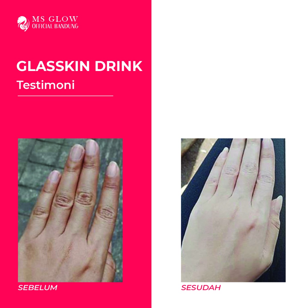 Glasskin Drink MS Glow Minuman Kesehatan Pencerah Kulit - By Ms.GlowOfficialBandung