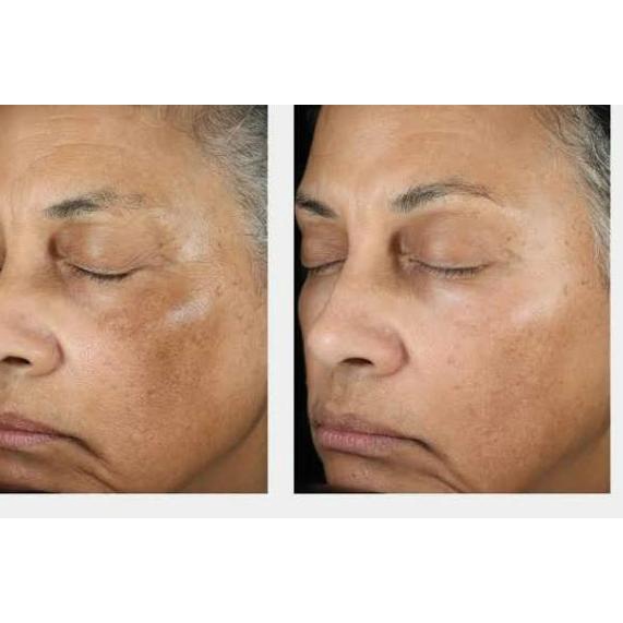 Diskon sekarang--Serum flex parah no 1 dunia | melatocin br pharm