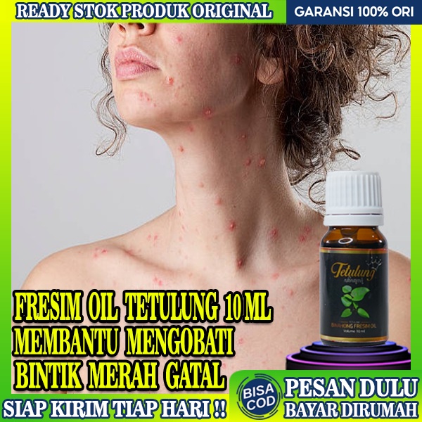 Jual Obat Kulit Bintik Merah Pada Kulitobat Penyakit Kulit Bintik