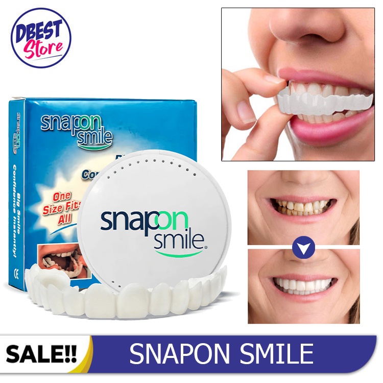 [ COD ] ORIGINAL 100% SNAP ON SMILE AUTHENTIC / GIGI PALSU SEPASANG ATAS BAWAH