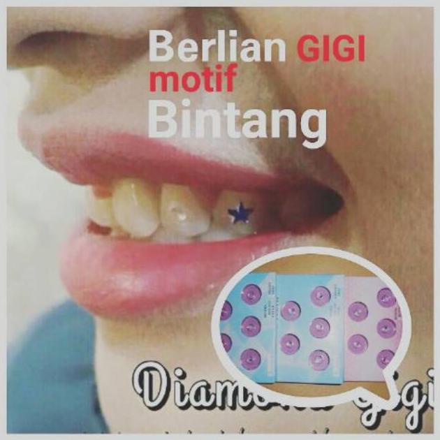 Berlian gigi / diamond model BINTANG