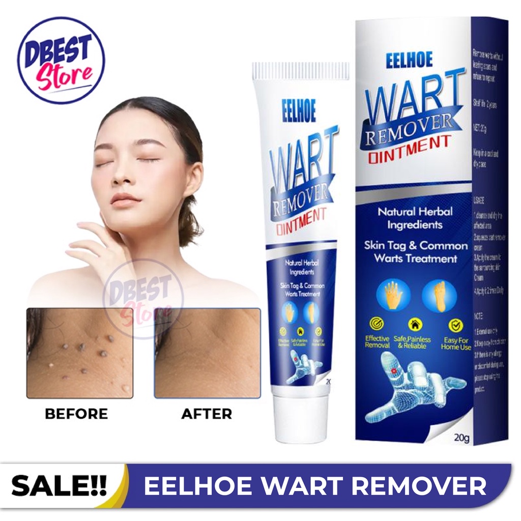 DBEST - ORIGINAL Skin Tag Remover SUMIFUN EELHOE Wart Remover Ointment | Penghilang Tahilalat &amp; Kutil