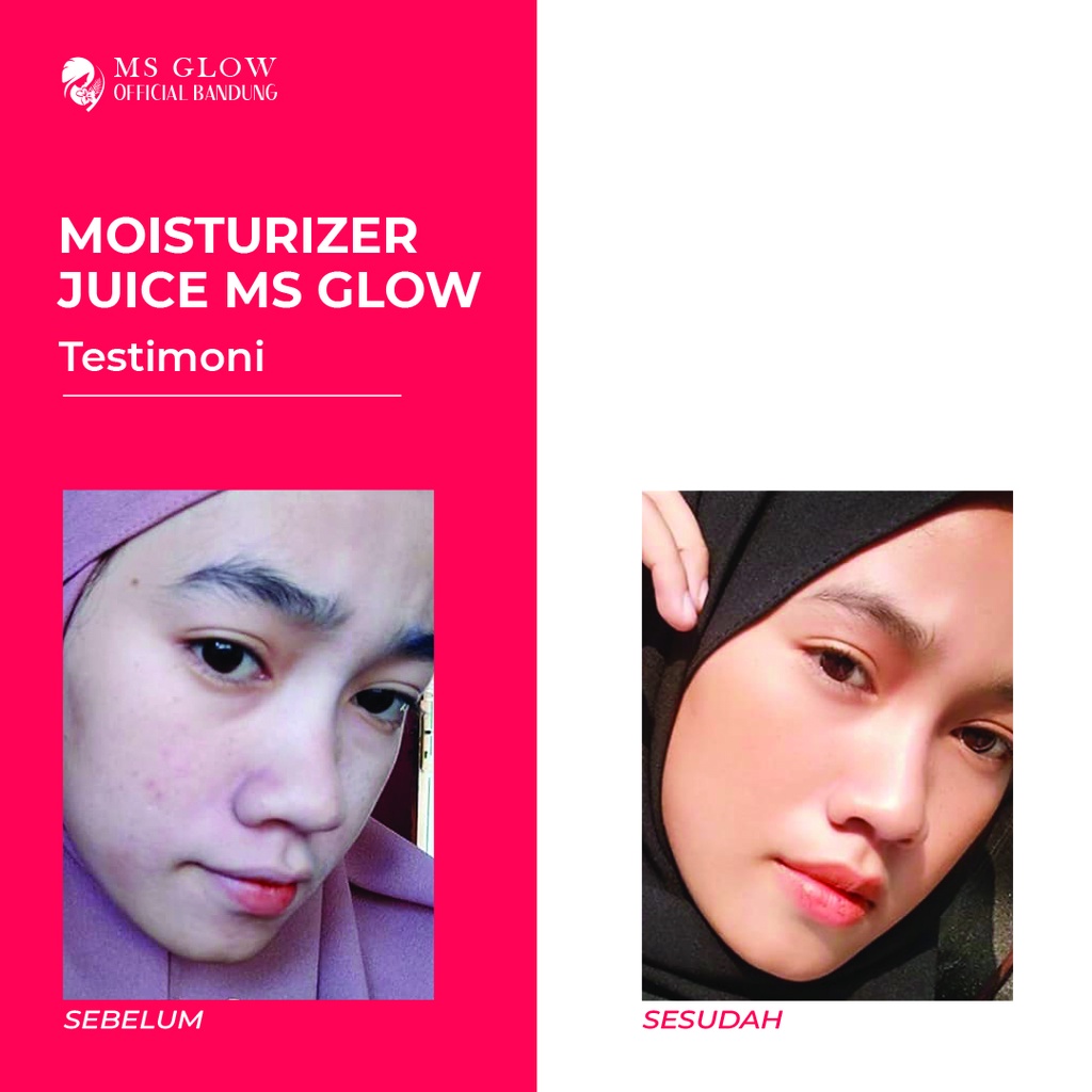 MS Glow Original Moisturizer Juice Pelembab Wajah Yuzu Cactus Watermelon - By Ms.glowofficialbandung