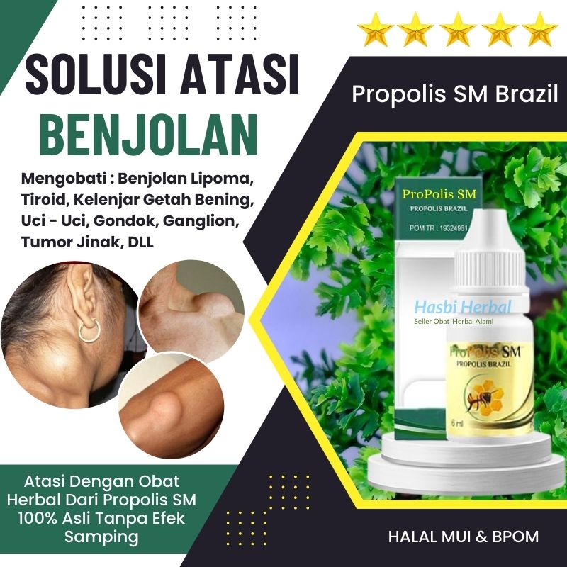 Jual Obat Benjolan Herbal Di Ketiak, Tiroid Di Leher, Benjolan Bengkak ...