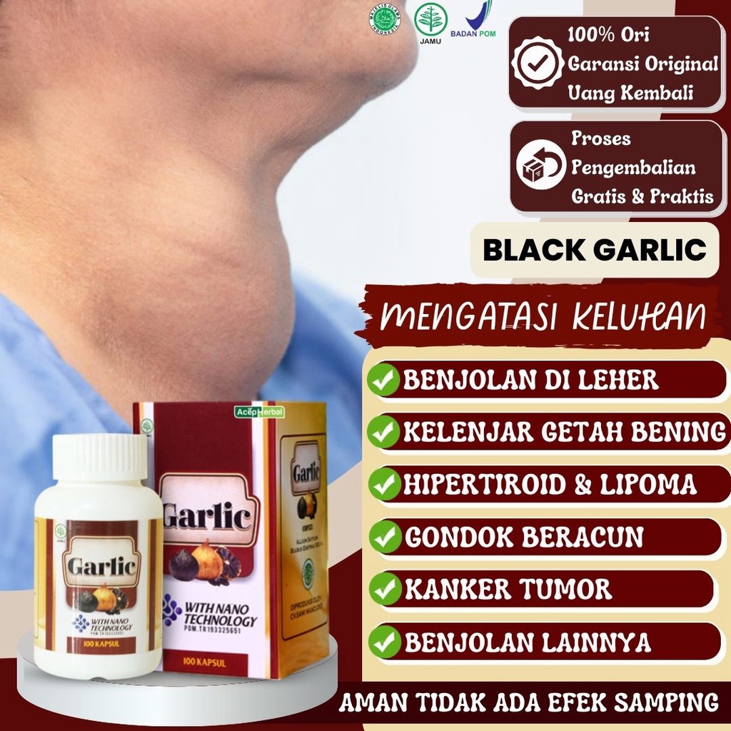 Jual Obat Penghancur Benjolan Di Leher Kelenjar Getah Bening Tiroid ...