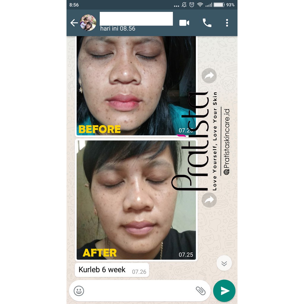 Brightening Liquid Serum Pratista Skincare Serum Niacinamide Penghilang Flek Hitam Pencerah Wajah Pratista Ori BPOM